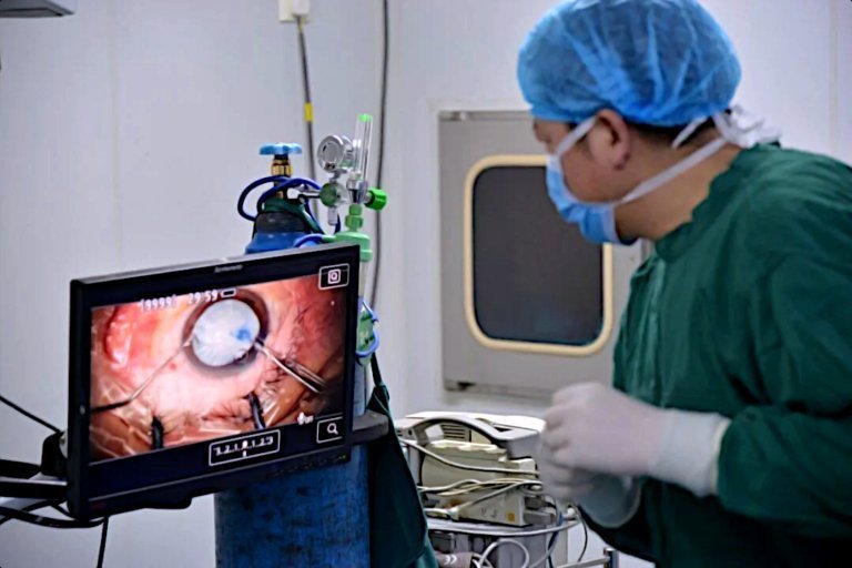 Staaroperatie ZONN opticiens